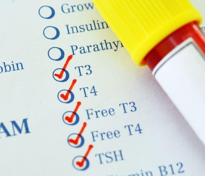 how often should a Thyroid test be carried out?
