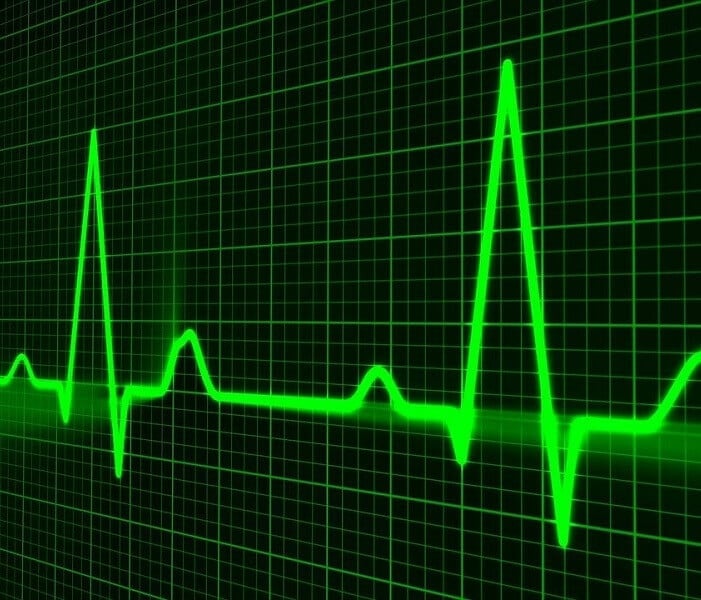 heart rate monitor graph