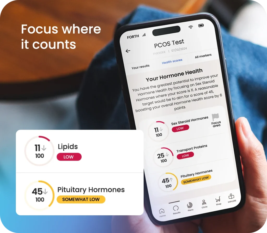 PCOS blood test results for Lipids and Pituitary Hormones on mobile app