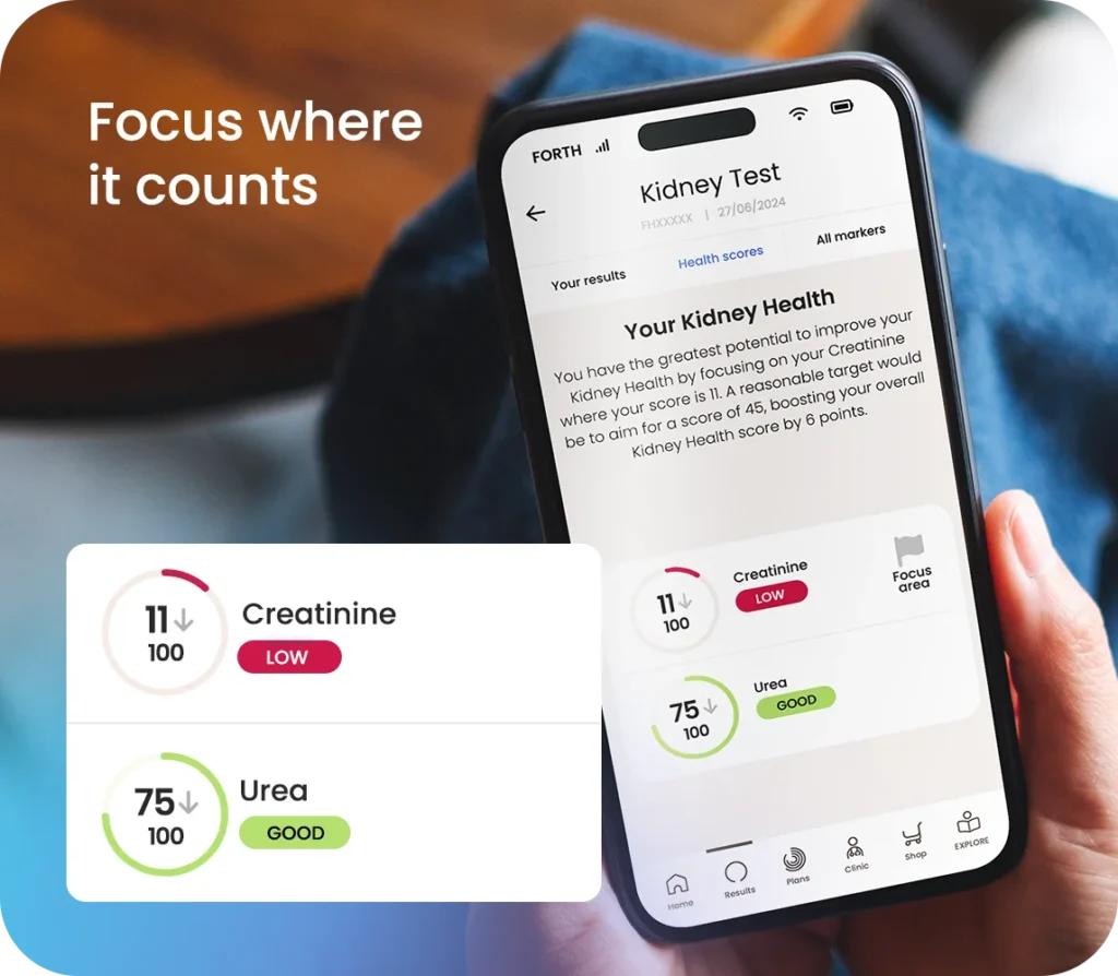 Kidney blood test - Focus where it counts