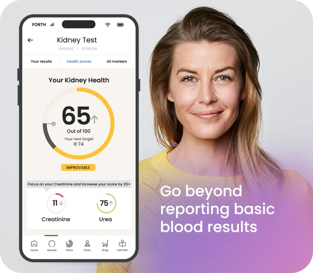 Kidney blood test - Go beyond reporting basic blood results
